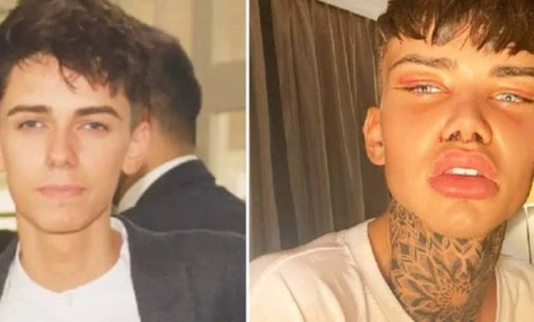 Levi Jed Murphy’s Before And After Looks: TikTok Star Underwent Plastic Surgery And Came Up With A Drastic Difference In Appearance